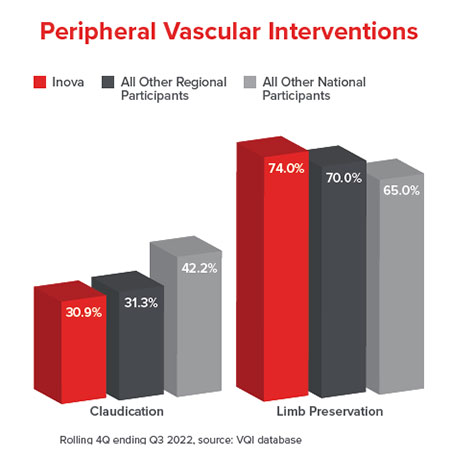 peripheral vascular interventions