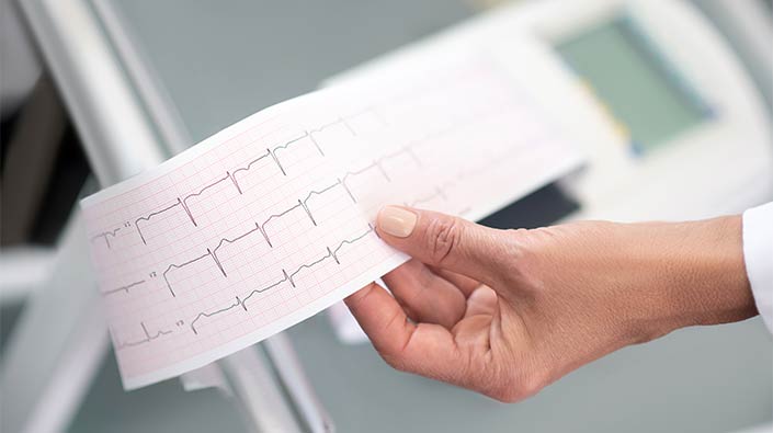 EKG print out 