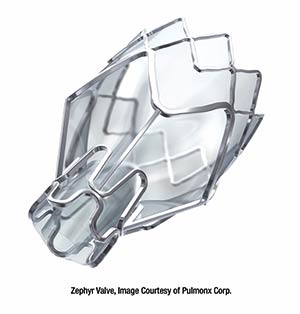 Zephyr® Endobronchial Valve