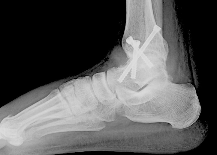 xray image