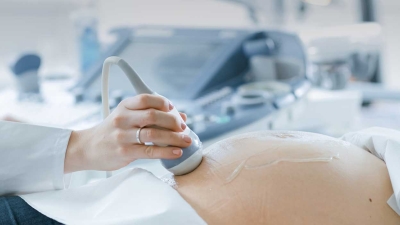 Antenatal sonogram