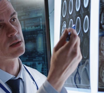 Neurosurgeons reviewing scans