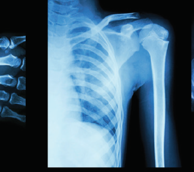 x-rays