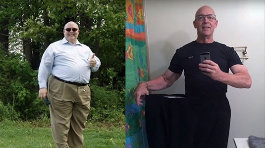 Craig's weight loss before and after surgery.