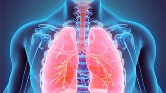 lung cancer image
