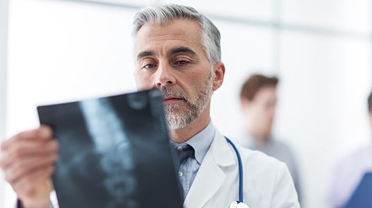male doctor looking at x-ray